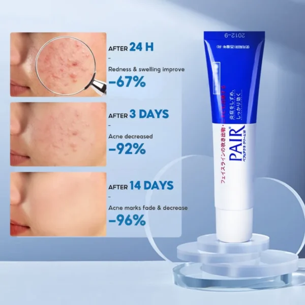 Lion - Pair Acne Cream W - Image 3