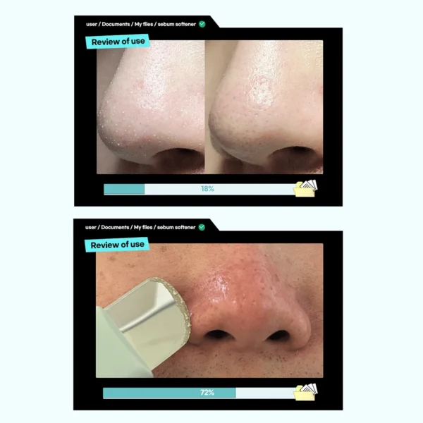 ilso - Super Melting Sebum Softener Bundle (Espátula y Serum) - Image 2